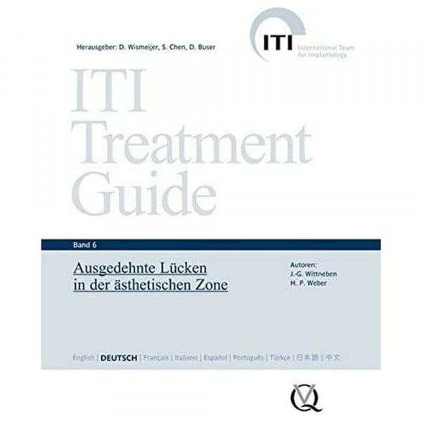 Daniel Buser (Hrsg.) ITI Treatment Guide Band 6: Ausgedehnte Lücken in der ästhetischen Zone (ITI Treatment Guide: Deutsche Ausgabe)
