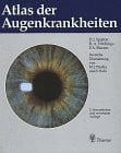 Hitchings, Roger A. Atlas der Augenkrankheiten