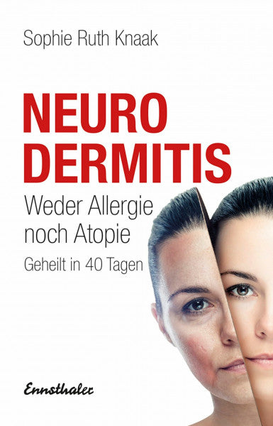 Knaak, Sophie Ruth Neurodermitis: Weder Allergie noch Atopie - Geheilt in 40 Tagen