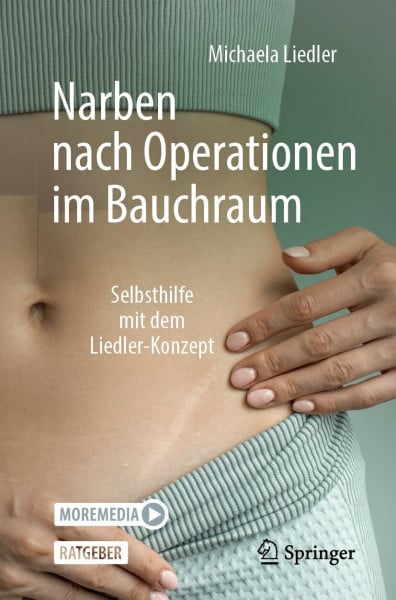 Liedler, Michaela Narben nach Operationen im Bauchraum: Selbsthilfe mit dem Liedler-Konzept