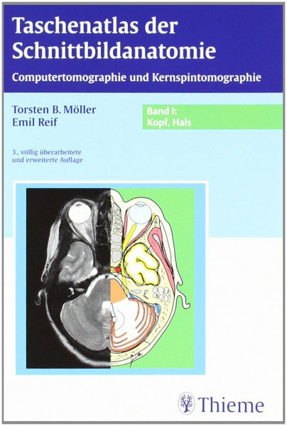 Möller, Torsten Bert Taschenatlas der Schnittbildanatomie: Band I: Kopf, Hals