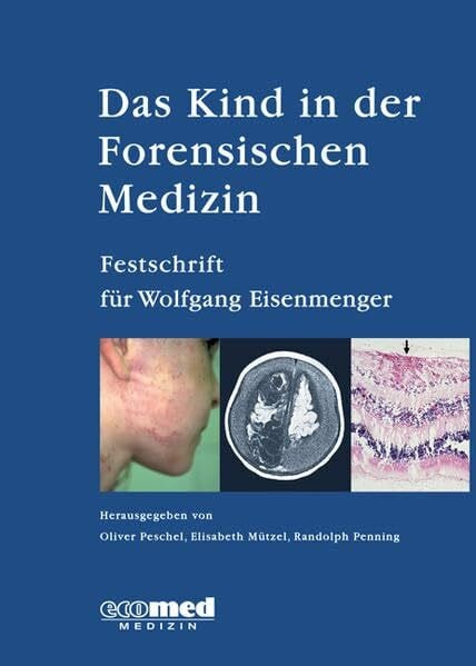 Peschel, Oliver Das Kind in der Forensischen Medizin: Festschrift für Wolfgang Eisenmenger