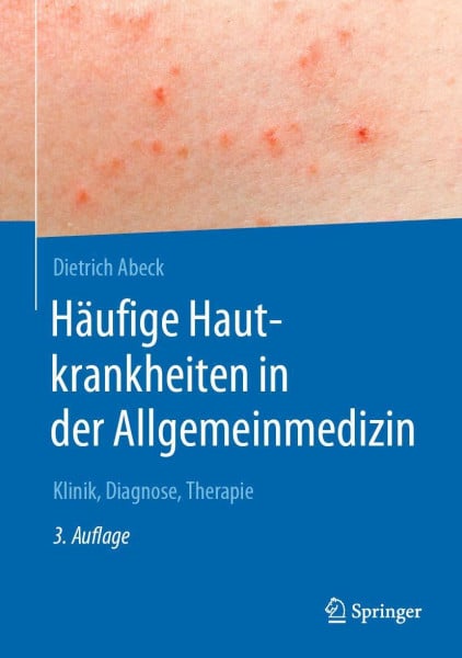 Abeck, Dietrich Häufige Hautkrankheiten in der Allgemeinmedizin: Klinik, Diagnose, Therapie